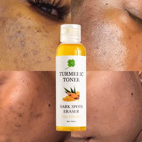 organic facial care turmeric toner anti acne remove pimple tightening skin remove dark spot tone corrector natural herbal